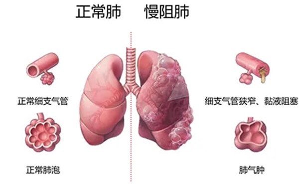 1764905985973652.jpg 640_wx_fmt=png&from=appmsg&tp=webp&wxfrom=5&wx_lazy=1(1).jpg